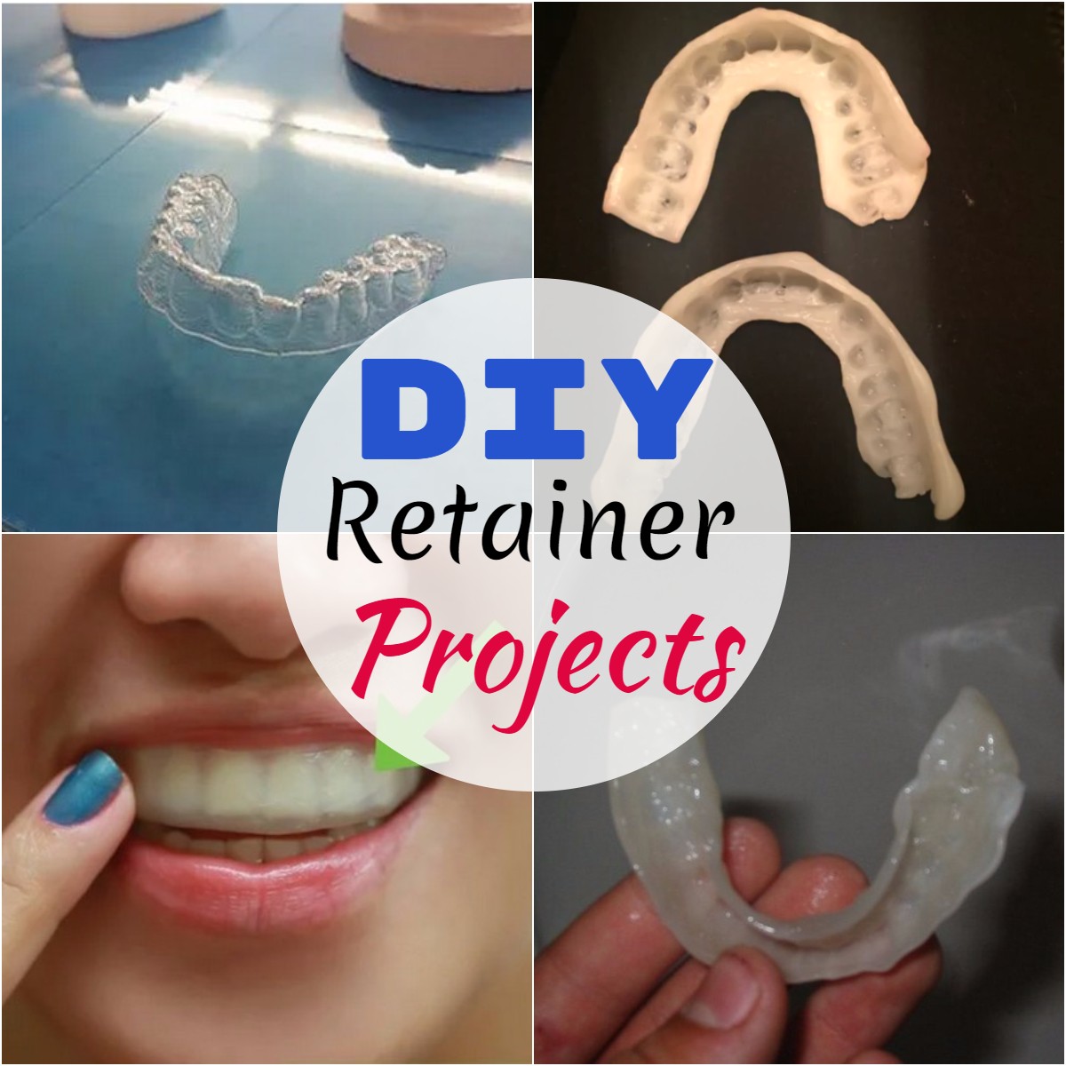 DIY Retainer Projects